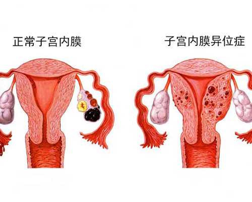 中国供卵市场情况如何,冻胚移植前打免疫球蛋白的姐妹可以聊聊效果吗？
