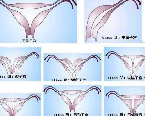 中国捐卵网,湖南试管婴儿**子医院排名附试管助孕机构成功率一览