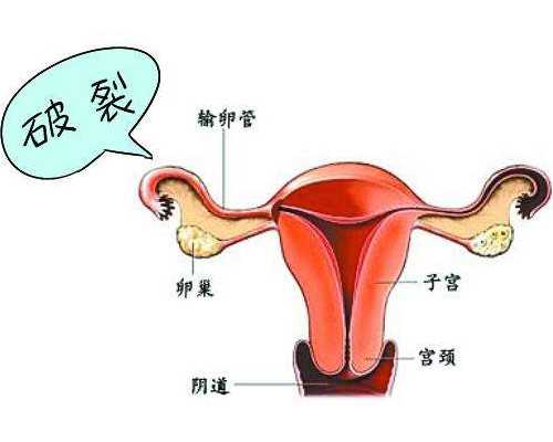 国内代生龙凤胎,上海启动吸入式新冠疫苗加强接种，哪些人适合？