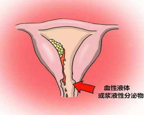 国内地下供卵哪家好,详解胎位roa是什么意思,准妈妈们要知道！
