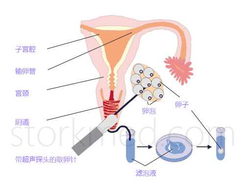 国内供卵去哪里找,鹿角胶可制作阿胶糕固本膏吗？